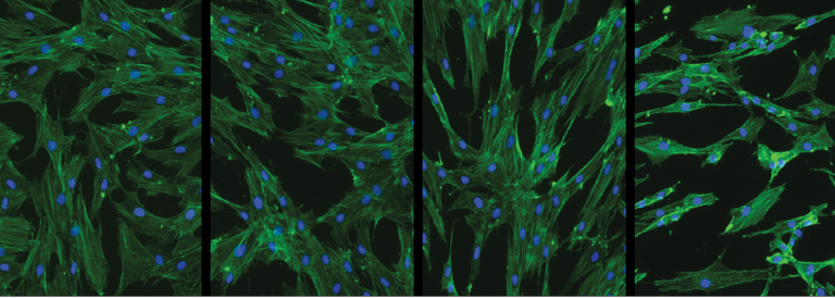 Illustration of how palmitate alters the morphology of MSCs